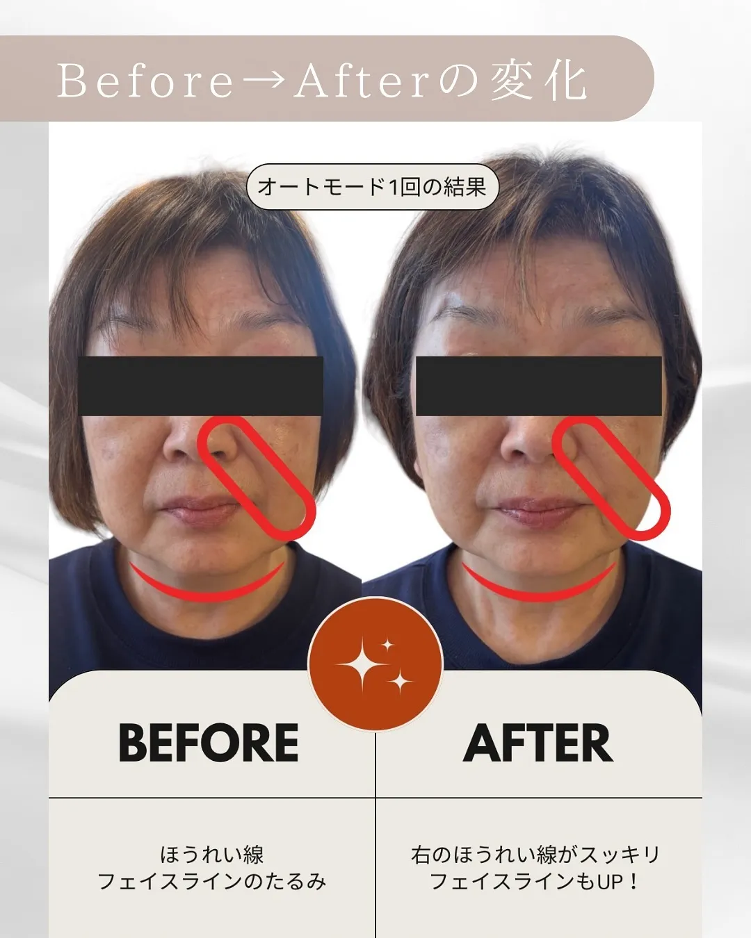 ＼今話題の“顔が変わる”美顔器が、よもぎ蒸し中に体験できる！...